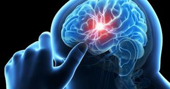    تمدد الأوعية الدموية الدماغية لها أعراض محددة تعرف عليها
