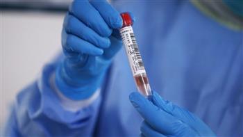   الإمارات تسجل 373 إصابة جديدة بفيروس كورونا 