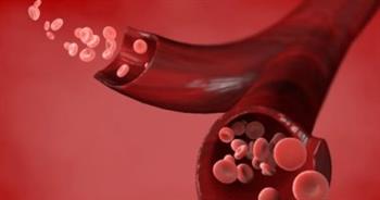   كيف تؤثر فصيلة دم الإنسان على إصابته بالأمراض؟