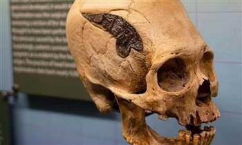   العثور على جمجمة شاب توفى منذ 8 آلاف سنة