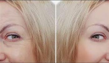 5 نصائح غذائية للحفاظ على الكولاجين