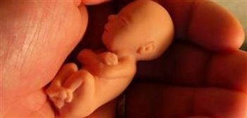   ما رأي الدين في إجهاض الطفل المصاب بعيوب خلقية؟