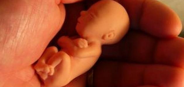 ما رأي الدين في إجهاض الطفل المصاب بعيوب خلقية؟