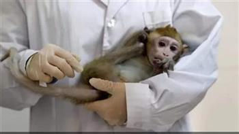الصحة الكويتية تتخذ سلسلة من الإجراءات الوقائية الاستباقية للكشف عن جدري القردة