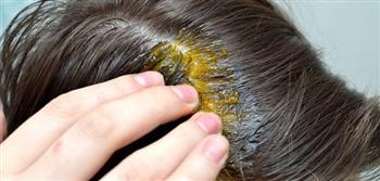   اسباب وعلاج تساقط الشعر