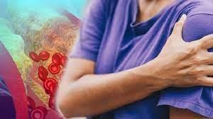 أعراض ارتفاع الكوليسترول الضار.. احترسوا من هذه العلامة الخطيرة
