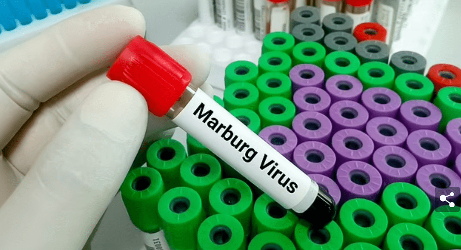 «الصحة العالمية»: غانا تعلن أول ظهور لمرض فيروس ماربورج في البلاد