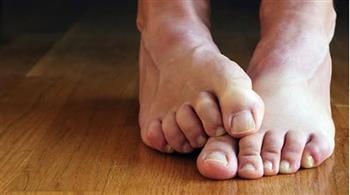   علامتان على أظافر قدميك مؤشر على مرض خطير