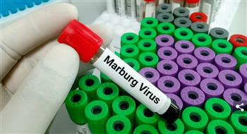   «الصحة العالمية»: غانا تعلن أول ظهور لمرض فيروس ماربورج في البلاد