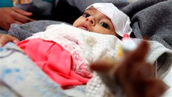   العراق يعلن ارتفاع عدد المصابين بـ الكوليرا إلى 160 والحمى النزفية لـ230