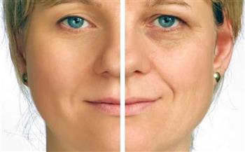   دراسة تكشف مدي فاعلية الكريمات في علاج تجاعيد الوجه