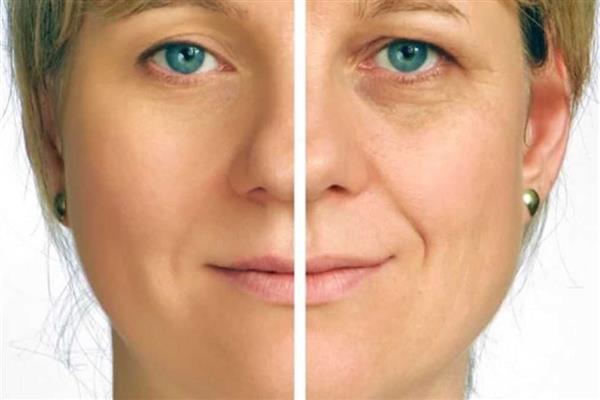 دراسة تكشف مدي فاعلية الكريمات في علاج تجاعيد الوجه