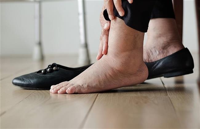 أطعمة تخلصك من احتباس السوائل بالجسم