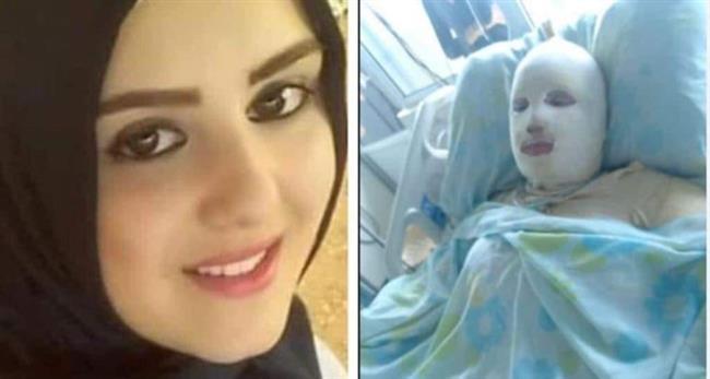 بسبب خلافات زوجية.. مقتل فتاة لبنانية بـ «طرابلس»