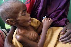   الأمم المتحدة تقدم 9.5 مليون دولار مساعدات طارئة لمتضررى المجاعة فى الصومال