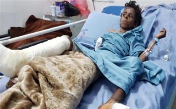   إصابة طفلين يمنيين بانفجار لغم من مخلفات العدوان السعودي بالحديدة