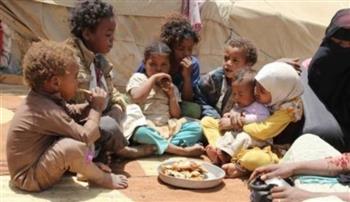   تقرير أممى: نصف مليون طفل يواجهون سوء التغذية الحاد في اليمن