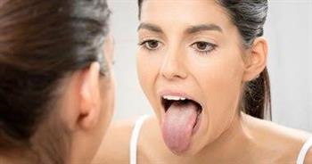   نصائح للتغلب على جفاف الفم