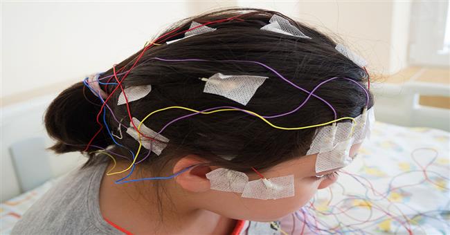 الجمعة المقبلة.. مؤتمر طبي بالأقصر لمناقشة علاج وجراحات اضطرابات كهربية المخ عند الأطفال
