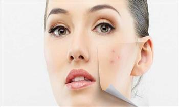   3 وصفات طبيعية للتخلص من البقع الداكنة على الوجه