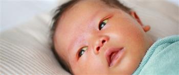   كيفية الوقاية من اليرقان في الأطفال حديثي الولادة