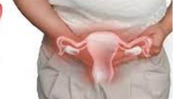   أورام الرحم الليفية.. ليست خطيرة ولكن تؤثر على  الحمل