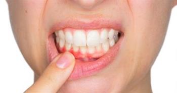   دراسة تكشف: خطورة الإصابات الرياضية على الأسنان 