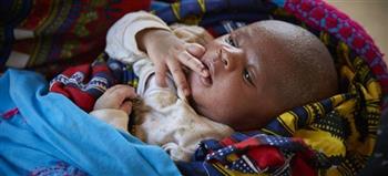   الأمم المتحدة: وفاة مليون طفل إثر مضاعفات الولادة المبكرة