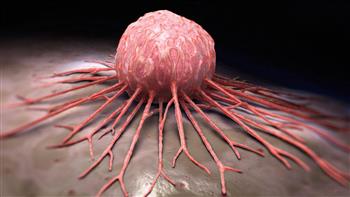   دراسة تكشف علاجا يقلل من حدوث الأورام السرطانية