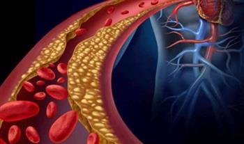   دراسة: أمل جديد يحمي من الإصابة بأمراض القلب ويُخفض الكوليسترول