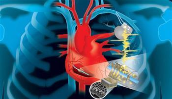 جامعة واشنطن تطور نظام توليد الطاقة لأجهزة تنظيم ضربات القلب