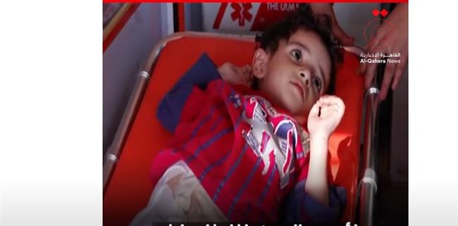 خالة الطفل الفلسطيني لؤي عبد الرحمن: نشكر الرئيس السيسي على سرعة الاستجابة