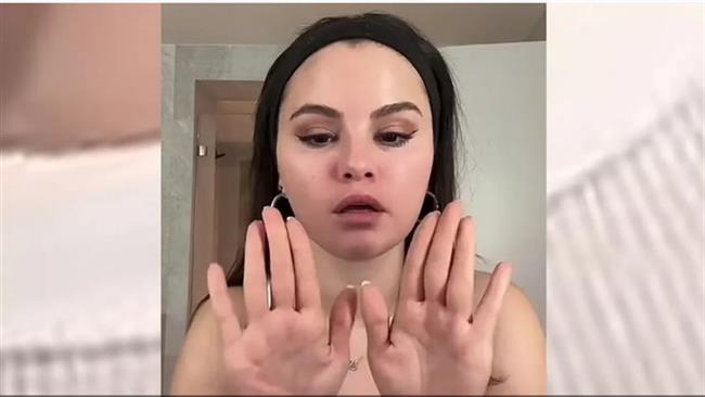 بعد فيديو سيلينا جوميز.. كل ما تريد معرفته عن مرض الذئبة 