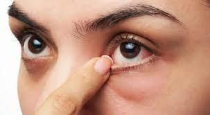   للتخلص من جفاف العين.. وصفات طبيعية لعلاجها
