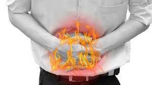 بطرق سهلة بسيطة.. علاج حموضة المعدة