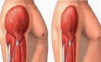   عميد كلية العلاج الطبيعي يشرح أسباب الإصابة بضمور العضلات