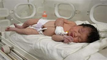   سوريا: طبيب "الطفلة المعجزة" يطمئن العالم بشأن صحتها