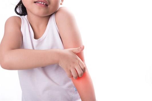 8 طرق طبيعية للتخلص من دمامل الاطفال