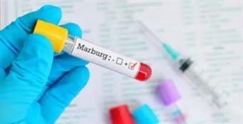 بعد وفاة 5 حالات بفيروس ماربورج.. الصحة: تحرير كروت مراقبة صحية للقادمين من تنزانيا