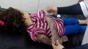 بطريقة وحشية.. أب يعذب طفلته ذات الـ 5 أعوام حتى الموت