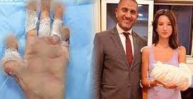   طبيب مصري ينقذ سائحة روسية من بتر يدها.. التفاصيل