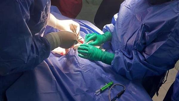 نجاح أول عملية جراحية لإصلاح عيب خلقي لرضيع عمره يوم واحد بالإسكندرية