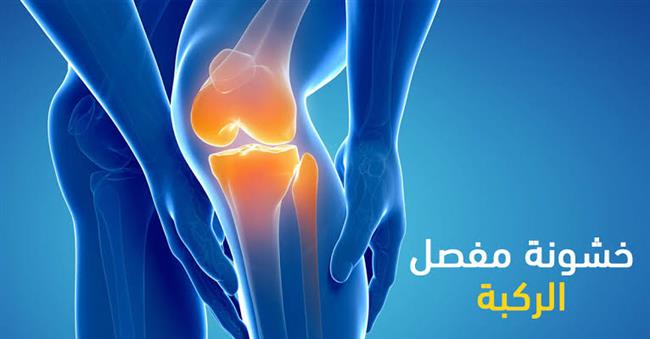 السيدات الأكثر عرضة للإصابة بخشونة المفاصل