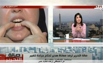 عزة مصطفى ترصد معاناة أم تحتاج لتغيير مفاصل الفكين بالغربية.. فيديو