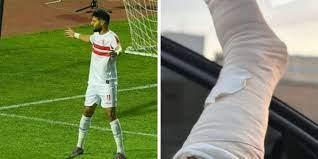 مصطفى شلبي ينشر صورة الإصابة التي تعرض لها أمام غزل المحلة