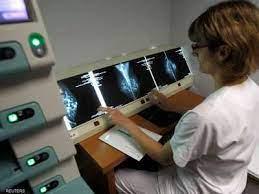 خطأ كارثي يفجع 400 شخص بشأن إصابتهم بمرض خطير