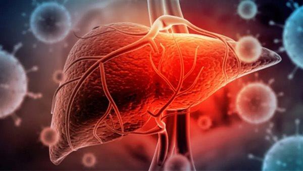 مجانًا.. آليات علاج مرضى سرطان الكبد بوحدات الفيروسات الكبدية 