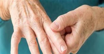 باحث: هناك زيادة فى الأشخاص المصابين بأمراض المناعة الذاتية