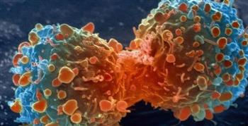   دراسة تكشف: تقنية طبية جديدة تساهم في علاج السرطان 