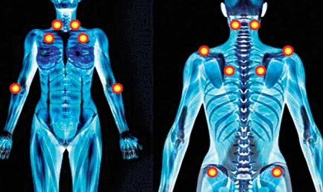 هل تعانى من التعب المستمر (الفيروماليجيا Fibromyalgia )؟  